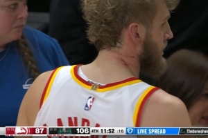 你们也太狠了吧！兰代尔劝架被误伤 脖子上三道血痕很鲜明！